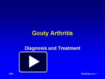 PPT – Gouty Arthritis PowerPoint presentation | free to view - id ...