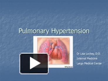 PPT – Pulmonary Hypertension PowerPoint presentation | free to view ...