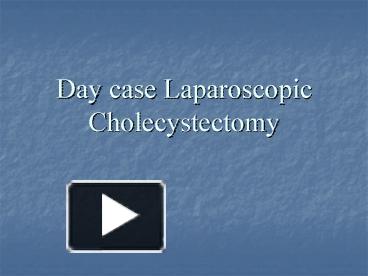 PPT – Day case Laparoscopic Cholecystectomy PowerPoint presentation ...