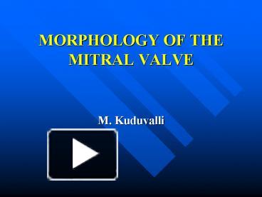 PPT – MORPHOLOGY OF THE MITRAL VALVE PowerPoint presentation | free to ...