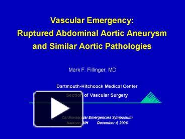 PPT – Vascular Emergency: Ruptured Abdominal Aortic Aneurysm and ...