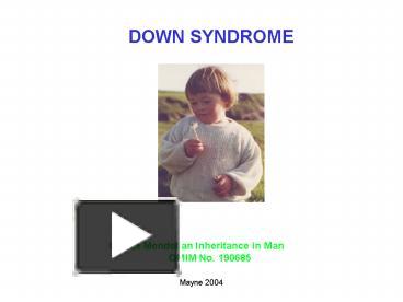 PPT – DOWN SYNDROME PowerPoint presentation | free to view - id: 382ca ...