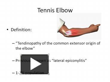 PPT – Tennis Elbow PowerPoint presentation | free to view - id: 3b77a9 ...