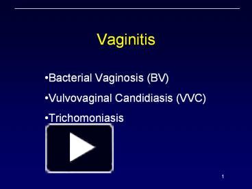 Ppt Vaginitis Bacterial Vaginosis Bv Vulvovaginal Candidiasis