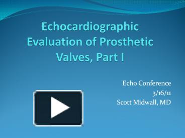 PPT – Echocardiographic Evaluation of Prosthetic Valves, Part I ...