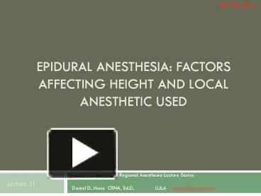 PPT – Epidural Anesthesia: Factors Affecting Height and Local ...