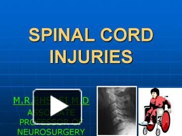 PPT – SPINAL CORD INJURIES PowerPoint presentation | free to view - id ...