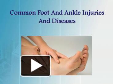 PPT – Common Foot and Ankle Injuries and Diseases PowerPoint ...