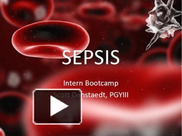 PPT – SEPSIS PowerPoint presentation | free to download - id: 64e37f-NTdhO