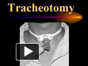 PPT – Tracheotomy PowerPoint presentation | free to view - id: 7ad18-ZDc1Z