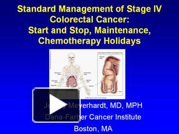 PPT – Standard Management of Stage IV Colorectal Cancer: Start and Stop ...