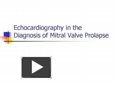 PPT – Echocardiography in the Diagnosis of Mitral Valve Prolapse ...