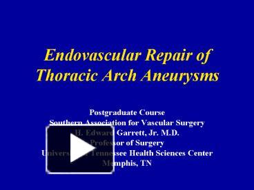 PPT – Endovascular Repair of Thoracic Arch Aneurysms PowerPoint ...