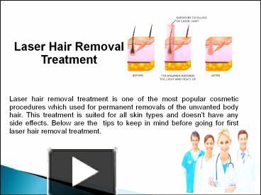 PPT – Laser Hair Removal Treatment PowerPoint presentation | free to ...