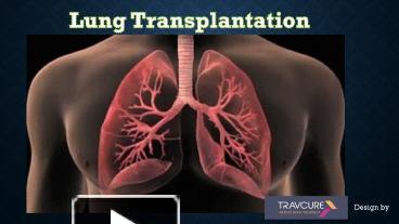 PPT – Lung Transplantation Surgery PowerPoint presentation | free to ...