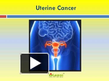 PPT – Uterine Cancer: Causes, Symptoms, risk factor, diagnosis and ...