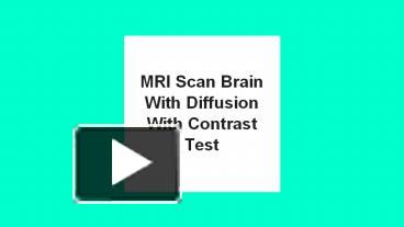 PPT – Mri scan brain with diffusion with contrast test PowerPoint ...