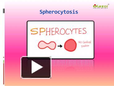 PPT – Spherocytosis: Causes, Symptoms, Daignosis, Prevention and ...