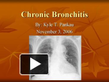 PPT – Chronic Bronchitis PowerPoint presentation | free to view - id ...