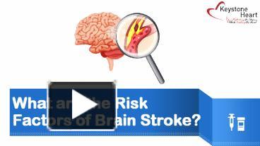 PPT – What are the Risk Factors of Brain Stroke? (1) PowerPoint ...