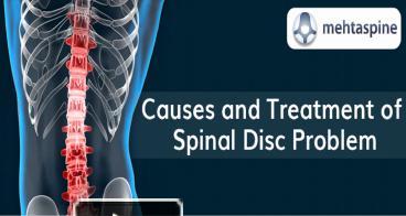 PPT – Causes and Treatment of Spinal Disc Problem - Mehta Spine ...