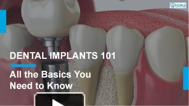 PPT – Dental Implant Procedure PowerPoint presentation | free to ...