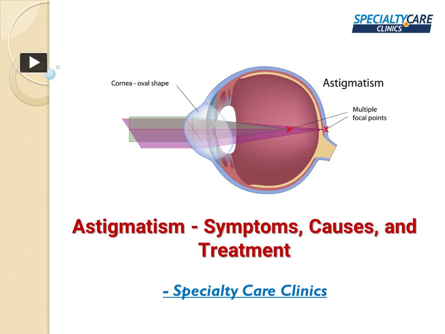 PPT – Astigmatism - Symptoms, Causes, and Treatment PowerPoint ...