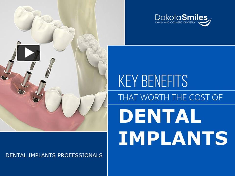 PPT – Dental Implants in Fargo- Dakota Smiles Family and Cosmetic ...