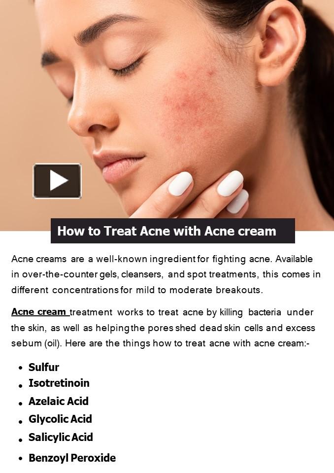 PPT – How to Treat Acne with Acne cream PowerPoint presentation | free ...