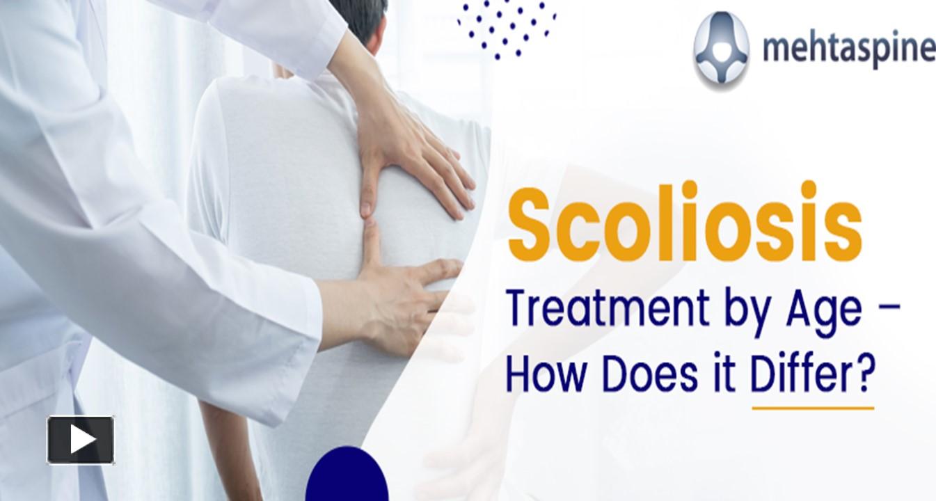 PPT – Scoliosis Treatment by Age: A Comprehensive Guide | Mehta Spine ...