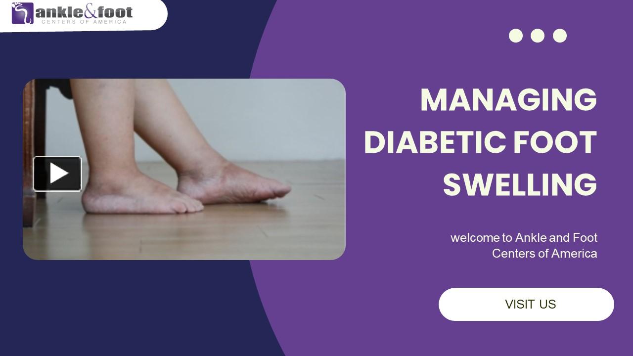 PPT – Managing Diabetic Foot Swelling PowerPoint presentation | free to ...