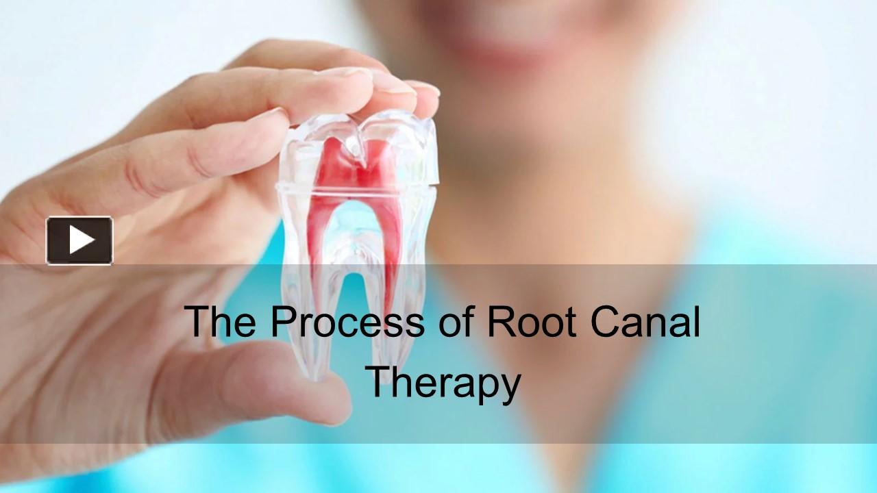 PPT – The Process of Root Canal Therapy PowerPoint presentation | free ...