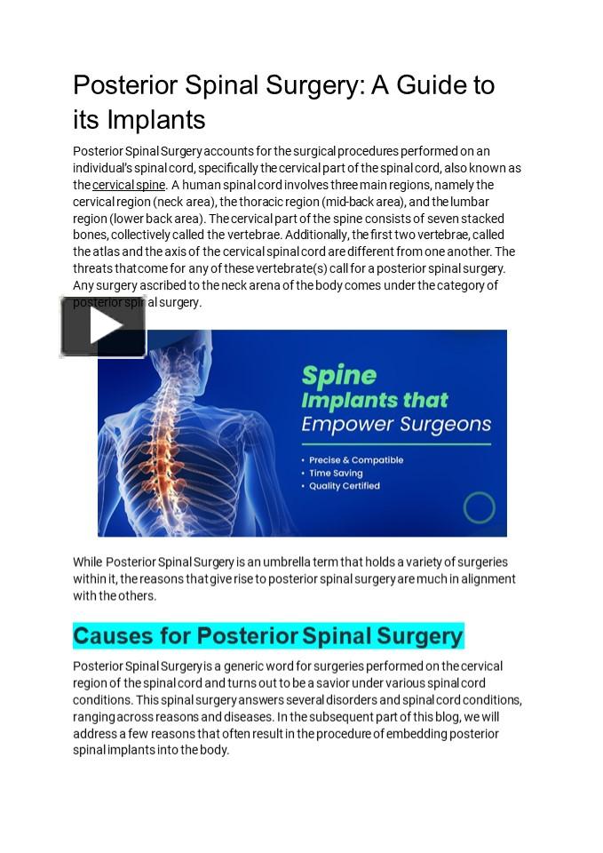 PPT – Posterior Spinal Surgery: A Guide to its Implants PowerPoint ...