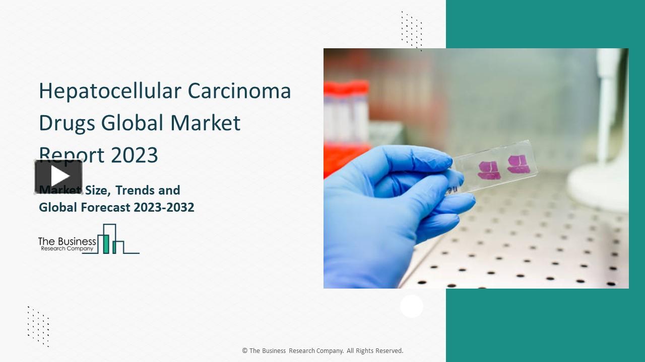 PPT – Hepatocellular Carcinoma Drugs Market Trends, Overview, Share ...