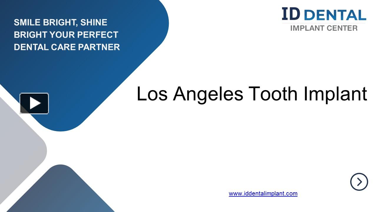 PPT – Transforming Smiles: Tooth Implants in Los Angeles PowerPoint ...