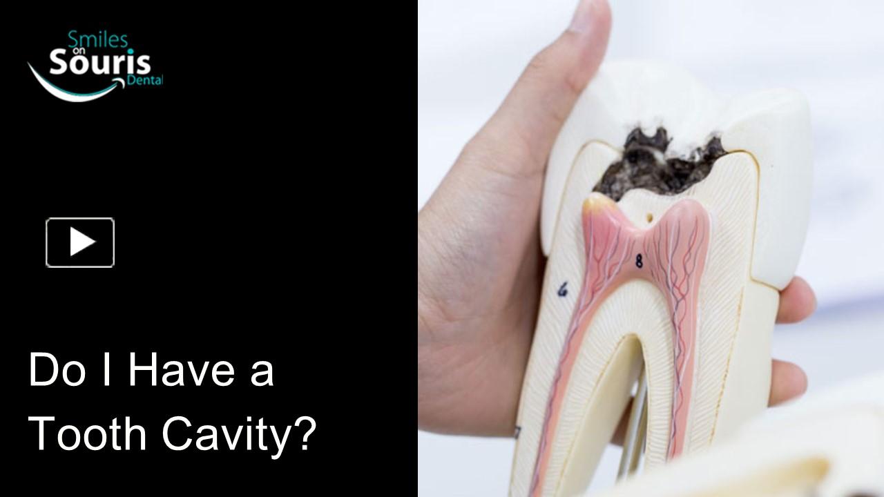 PPT – Detecting Tooth Cavities: A Guide to Understanding Your Oral ...