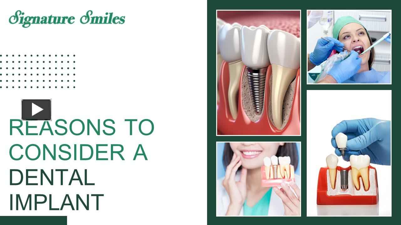 PPT – Exploring the Compelling Reasons for Dental Implants PowerPoint ...