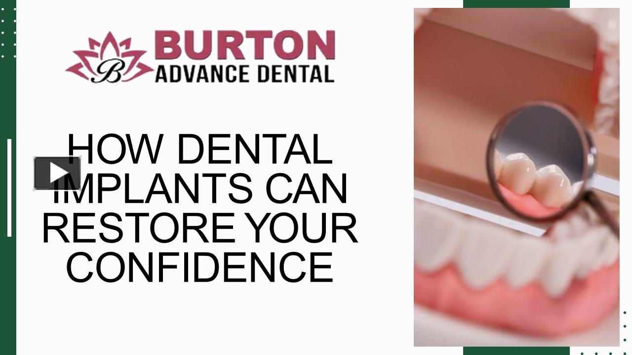 PPT – HOW DENTAL IMPLANTS CAN RESTORE YOUR CONFIDENCE PowerPoint ...