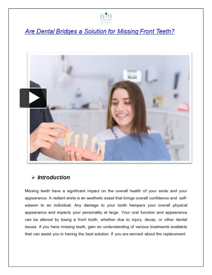 PPT – Are Dental Bridges a Solution for Missing Front Teeth? PowerPoint ...