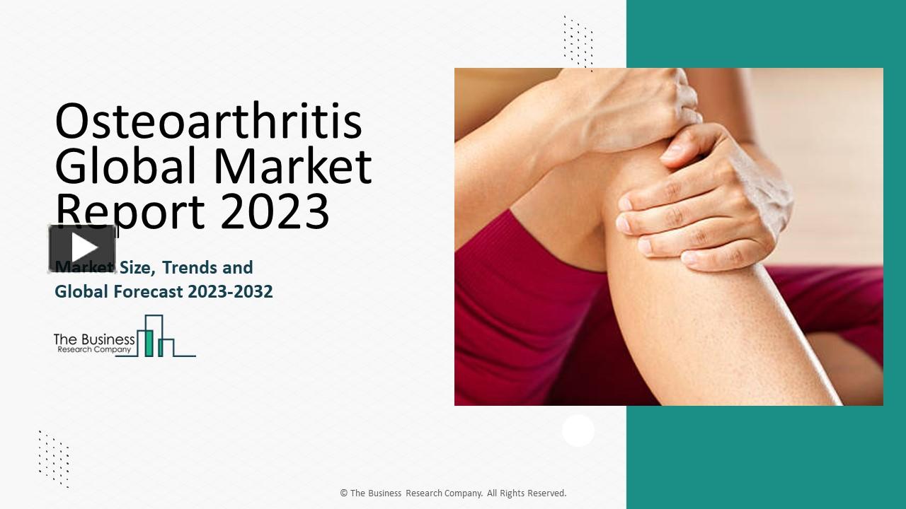 PPT – Osteoarthritis Market Size, Trends, Share And Opportunites To ...