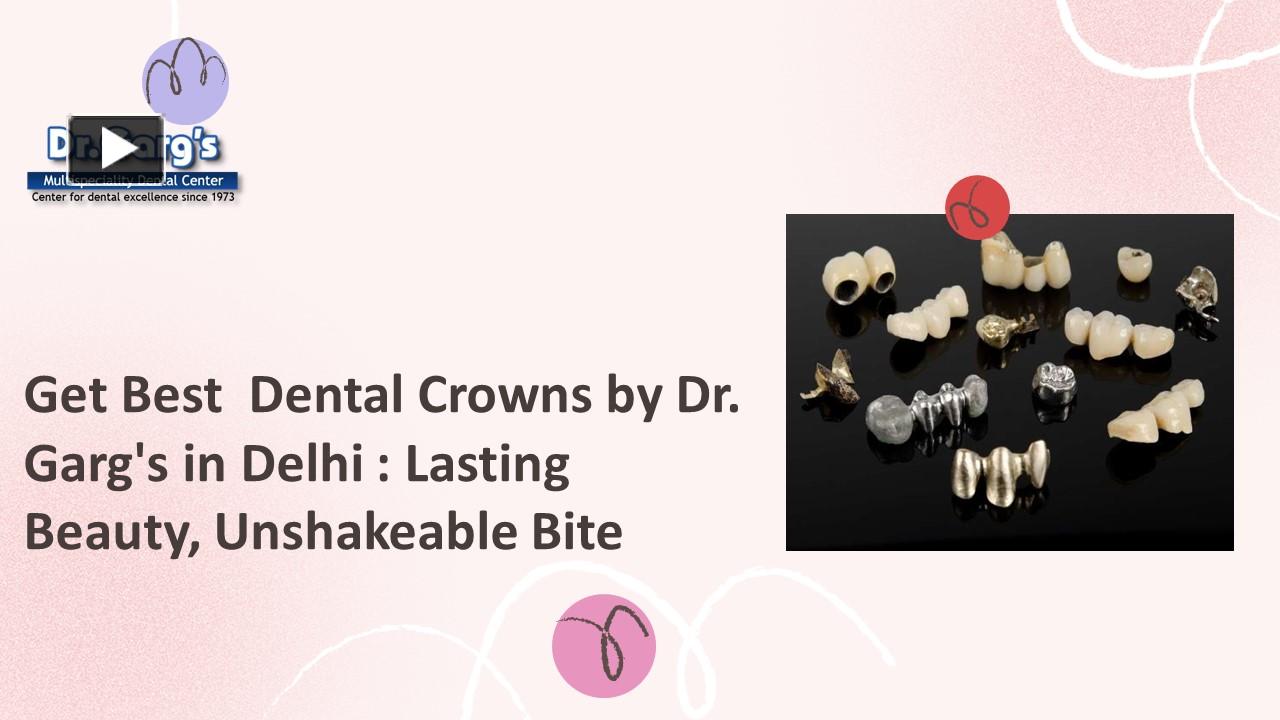 PPT – Get Best Dental Crowns by Dr. Garg's in Delhi : Lasting Beauty ...