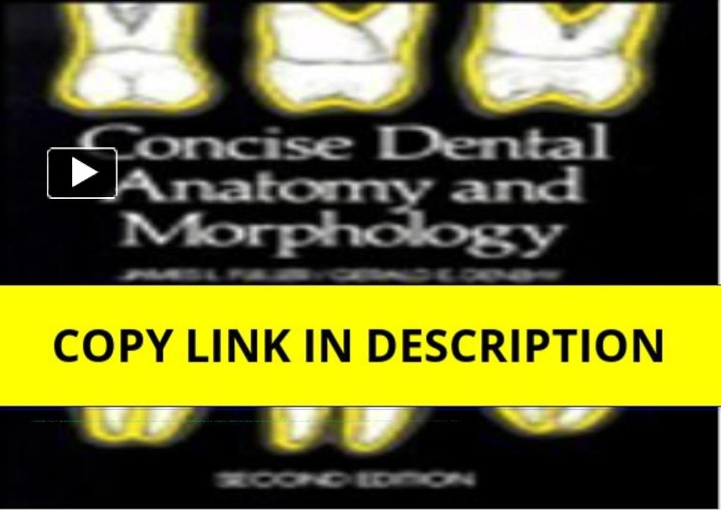 PPT – PDF KINDLE DOWNLOAD Concise Dental Anatomy and Morphology ...