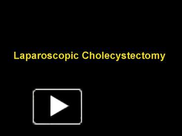 PPT – Laparoscopic Cholecystectomy PowerPoint presentation | free to ...