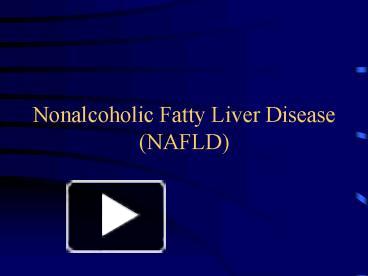 PPT – Nonalcoholic Fatty Liver Disease NAFLD PowerPoint presentation ...