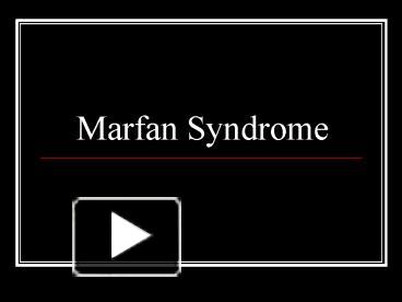 PPT – Marfan Syndrome PowerPoint presentation | free to view - id ...